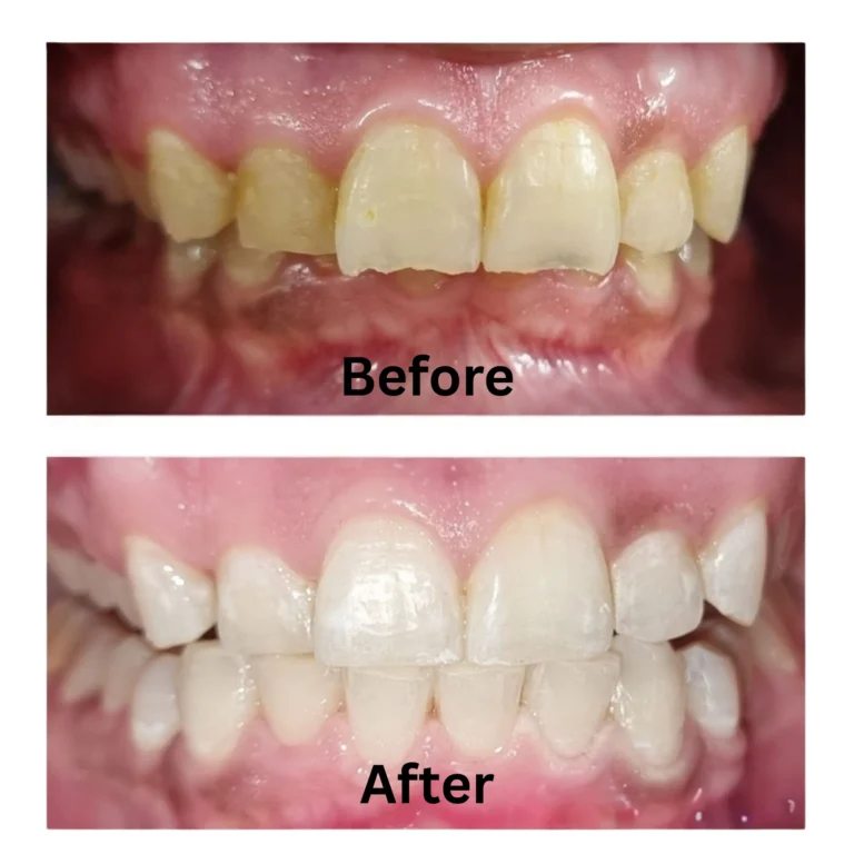 Dental Services 18 3