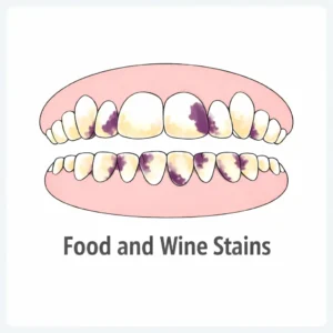 Food and wine stains on teeth