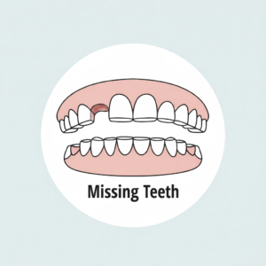 Missing Teeth