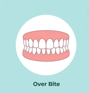 Over Bite 3