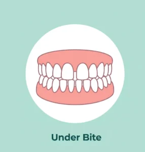 Under Bite 2