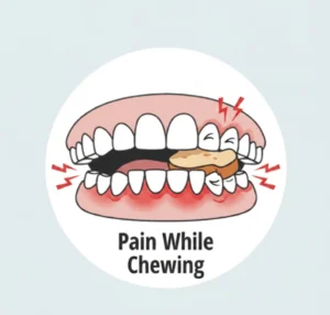 Pain while chewing treated with painless root canal Delhi