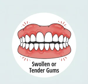 Swollen gums due to infection needing root canal treatment South Delhi
