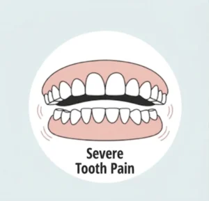 Severe tooth pain requiring root canal treatment in Delhi